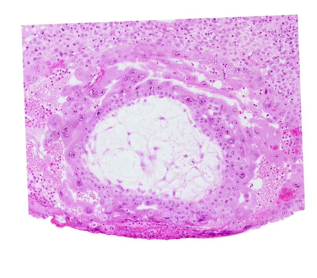 cytotrophoblast, extra-embryonic mesoblast, extra-embryonic reticulum, fibrous coagulum, lacunar vascular circle with maternal blood cells, syncytiotrophoblast, uterine cavity