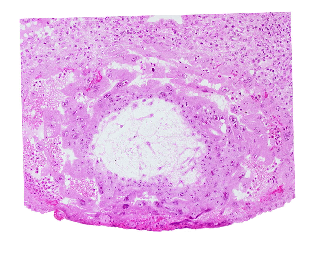 extra-embryonic reticulum, fibrous coagulum, lacunar vascular circle with maternal blood cells, uterine cavity