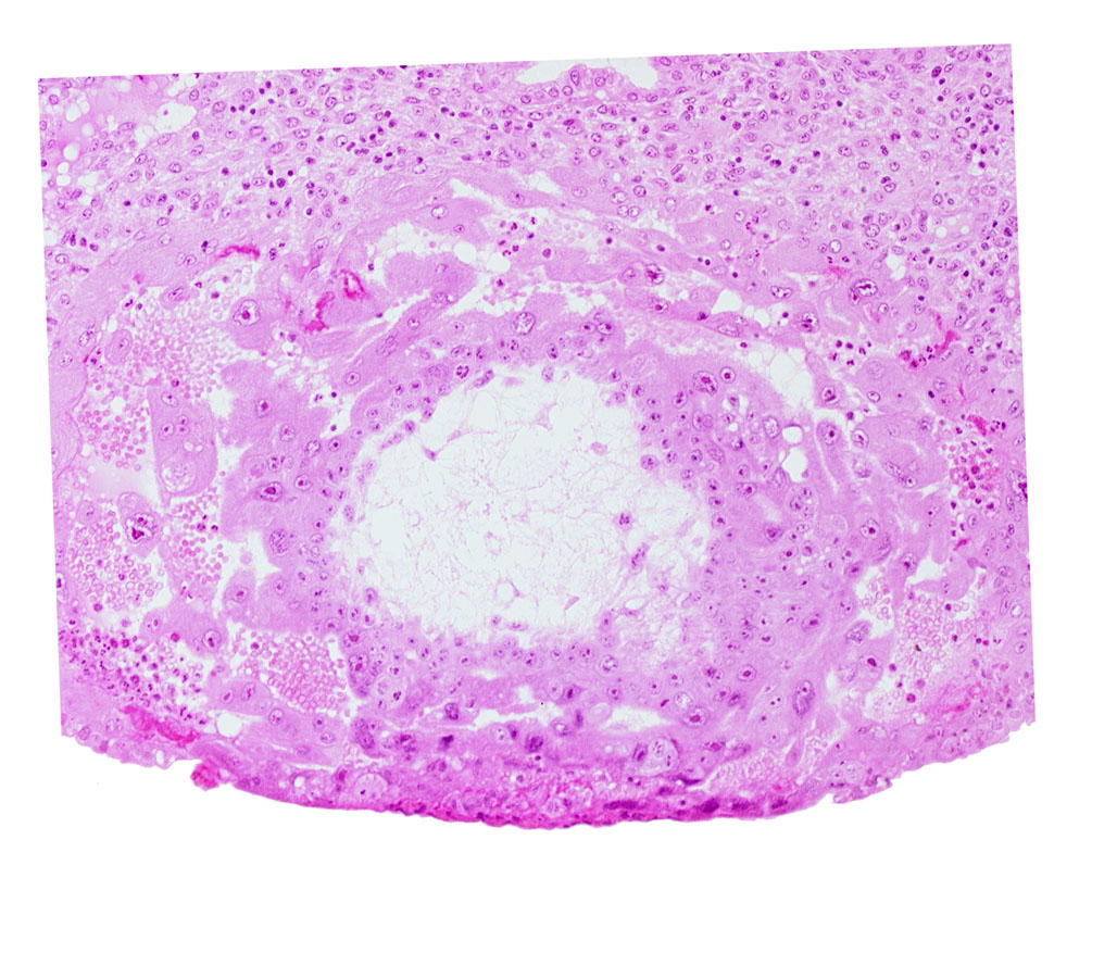 extra-embryonic reticulum, lacunar vascular circle with maternal blood cells, uterine cavity