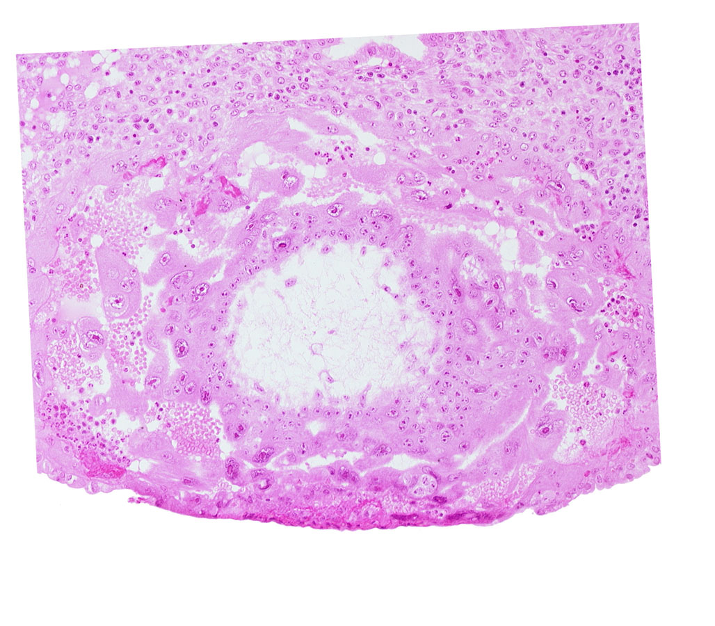 extra-embryonic reticulum, syncytiotrophoblast, uterine cavity