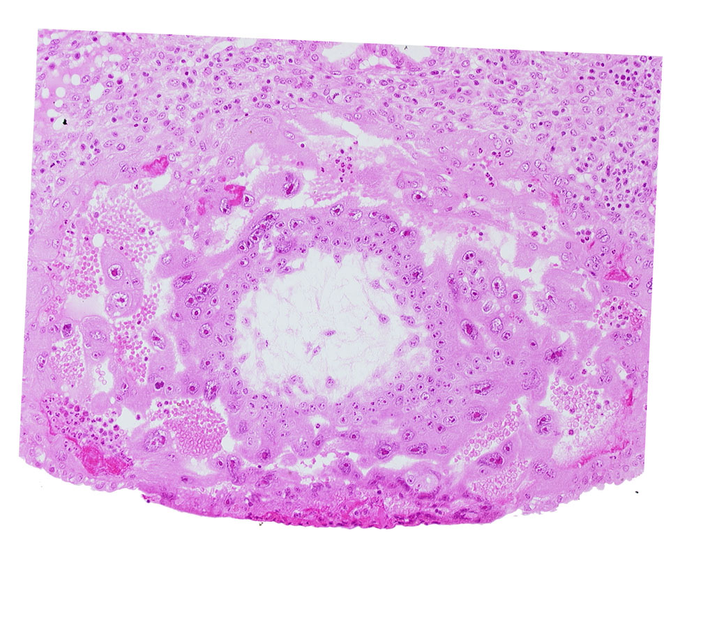 chorionic cavity, fibrous coagulum, syncytiotrophoblast, uterine cavity