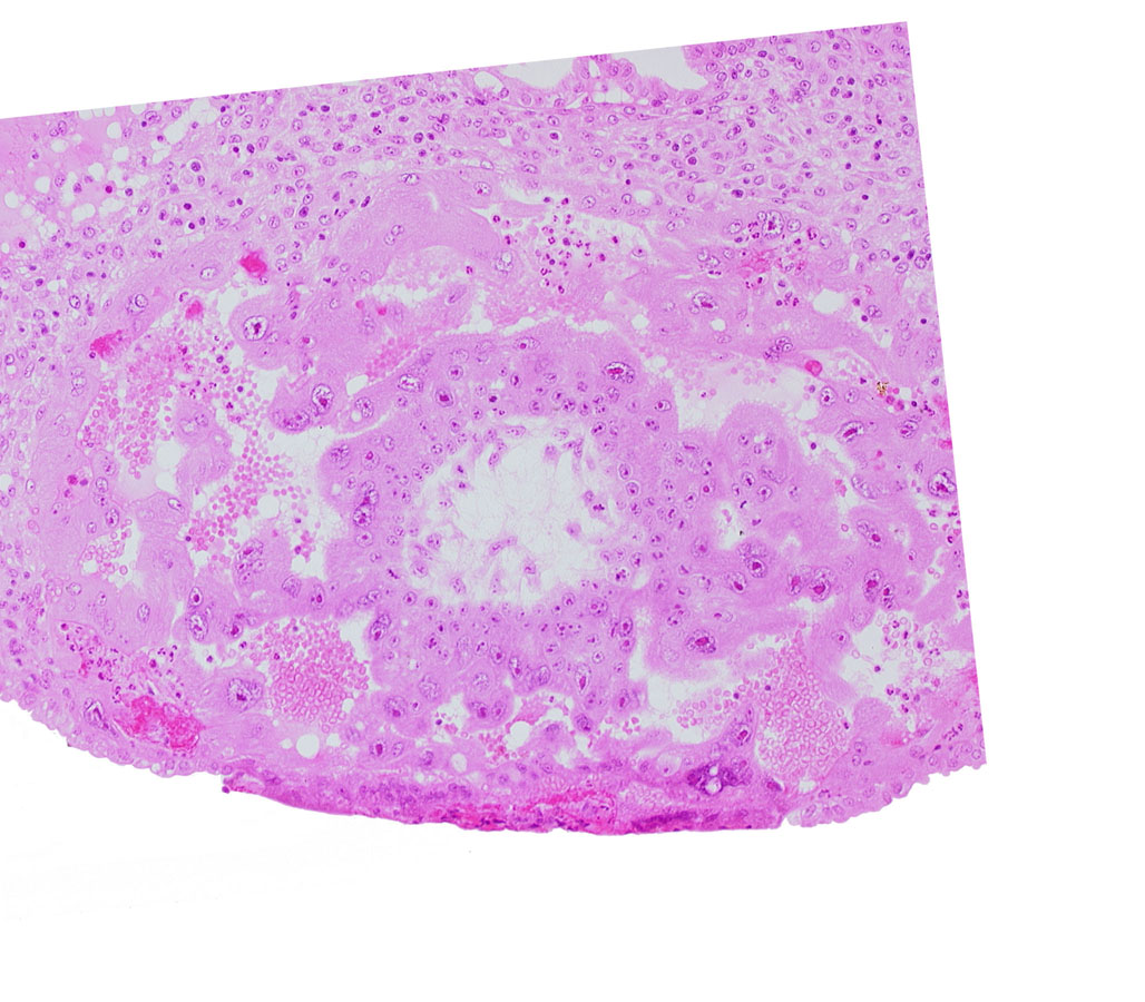 cytotrophoblast, syncytiotrophoblast, uterine cavity