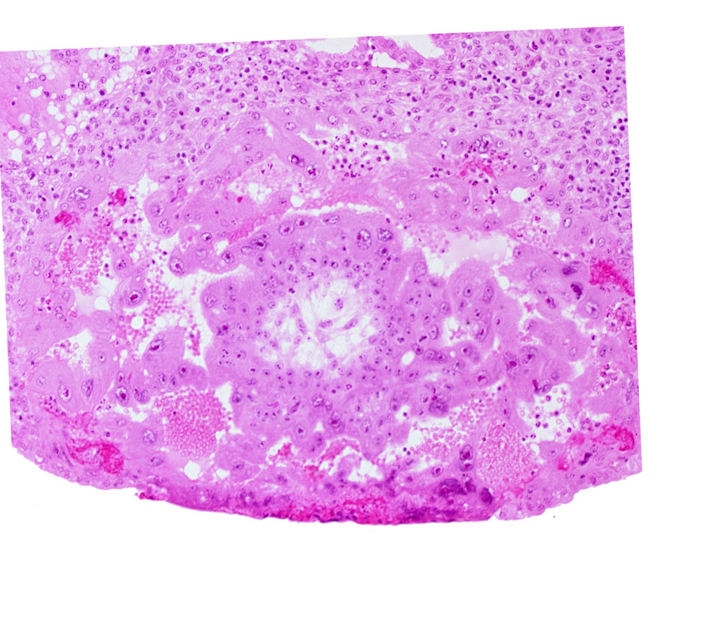 cytotrophoblast, edge of chorionic cavity, maternal blood cells in intercommunicating lacunae, syncytiotrophoblast