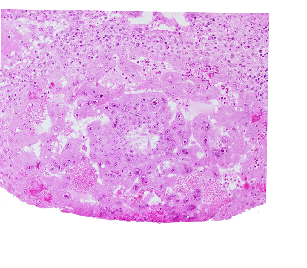 cytotrophoblast, edge of extra-embryonic reticulum, maternal blood cells in intercommunicating lacunae, syncytiotrophoblast