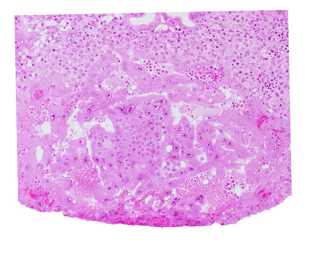 maternal blood cells in intercommunicating lacunae, syncytiotrophoblast