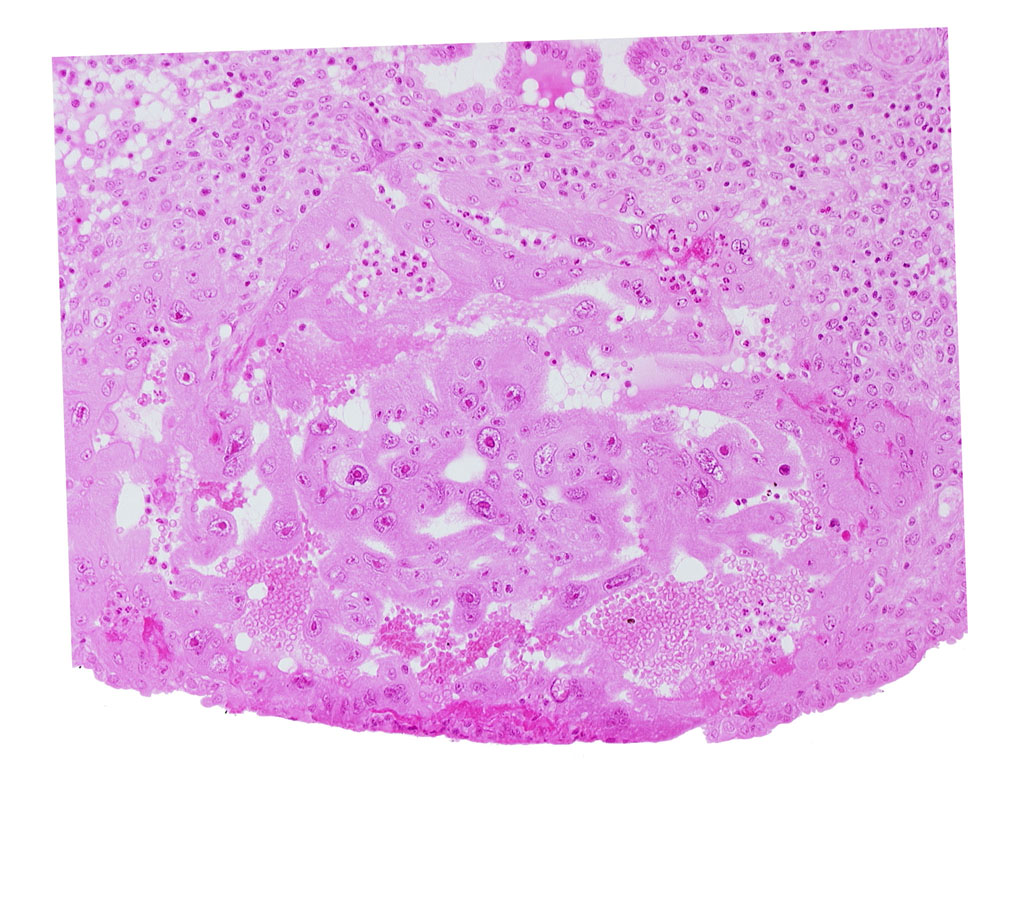 endometrial epithelium, syncytiotrophoblast, uterine cavity