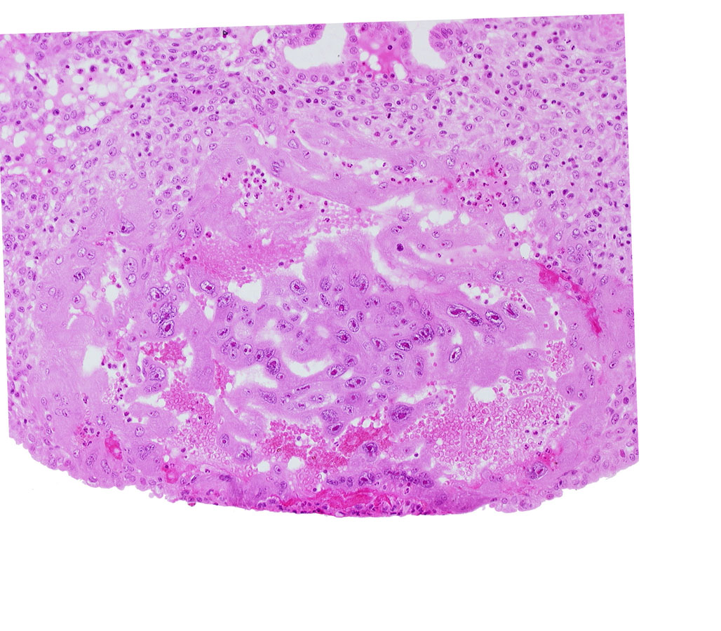 endometrial epithelium, syncytiotrophoblast, uterine cavity