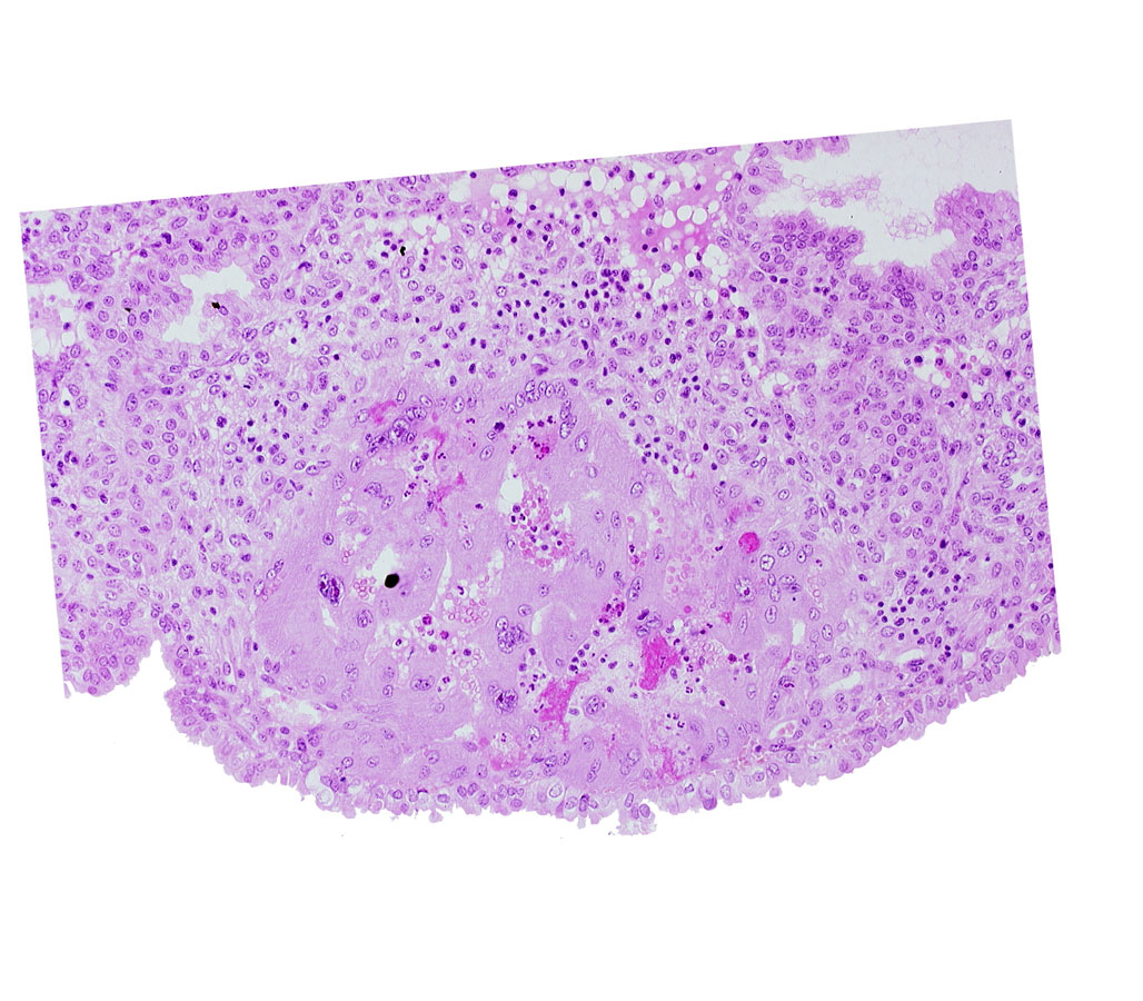 maternal blood cells in trophoblast lacuna, syncytiotrophoblast, uterine cavity