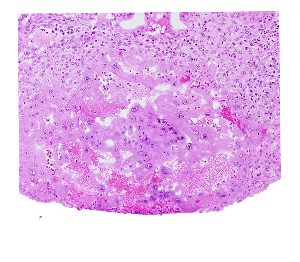 endometrial epithelium, lacunar vascular circle, syncytiotrophoblast, uterine cavity