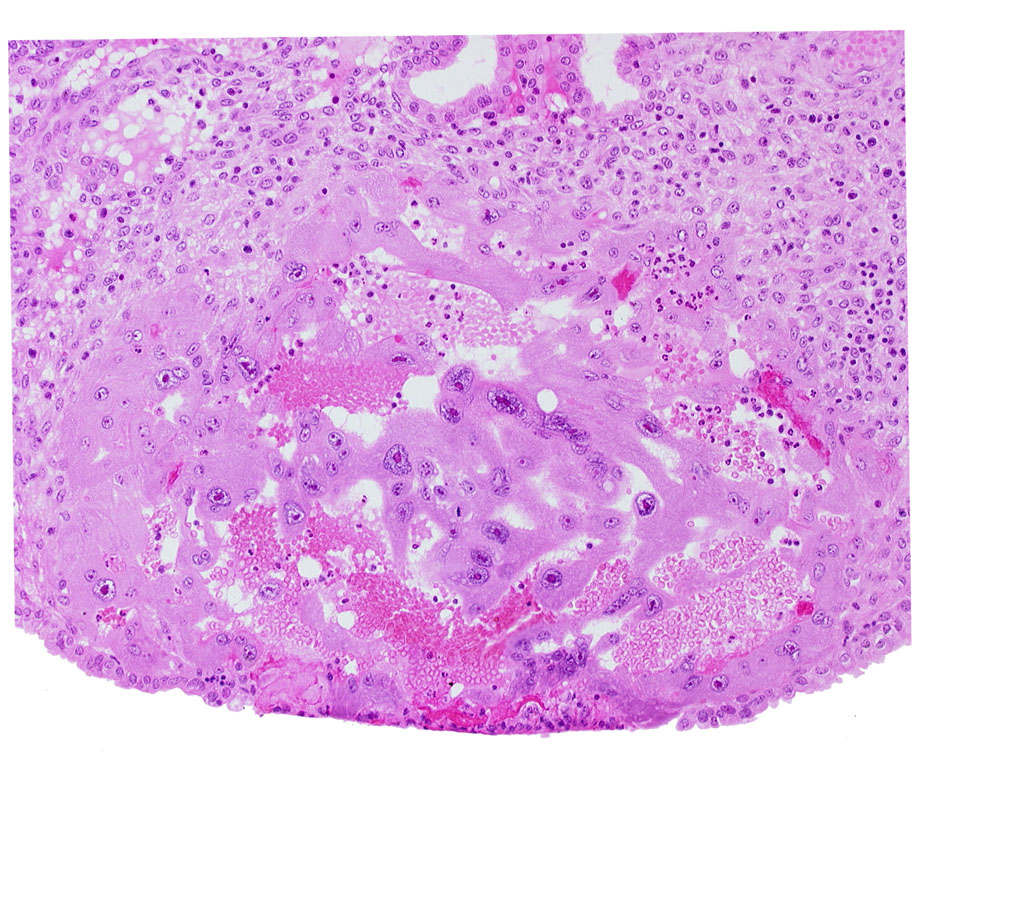 endometrial epithelium, lacunar vascular circle, uterine cavity