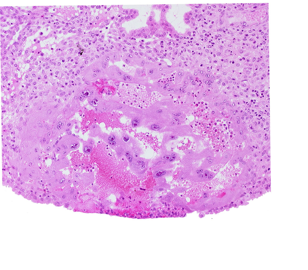 endometrial epithelium, lacunar vascular circle, maternal blood cells in trophoblast lacuna, syncytiotrophoblast, uterine cavity