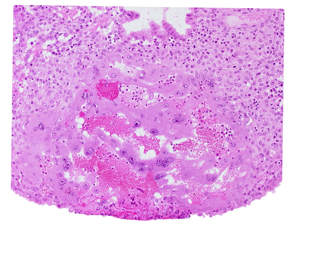 endometrial epithelium, endometrial stroma (decidua), lacunar vascular circle, maternal blood cells in trophoblast lacuna, syncytiotrophoblast, uterine cavity