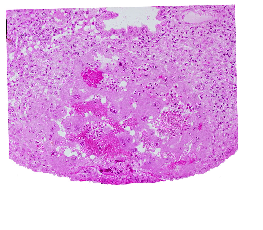 lacunar vascular circle, maternal blood cells in trophoblast lacuna, uterine cavity