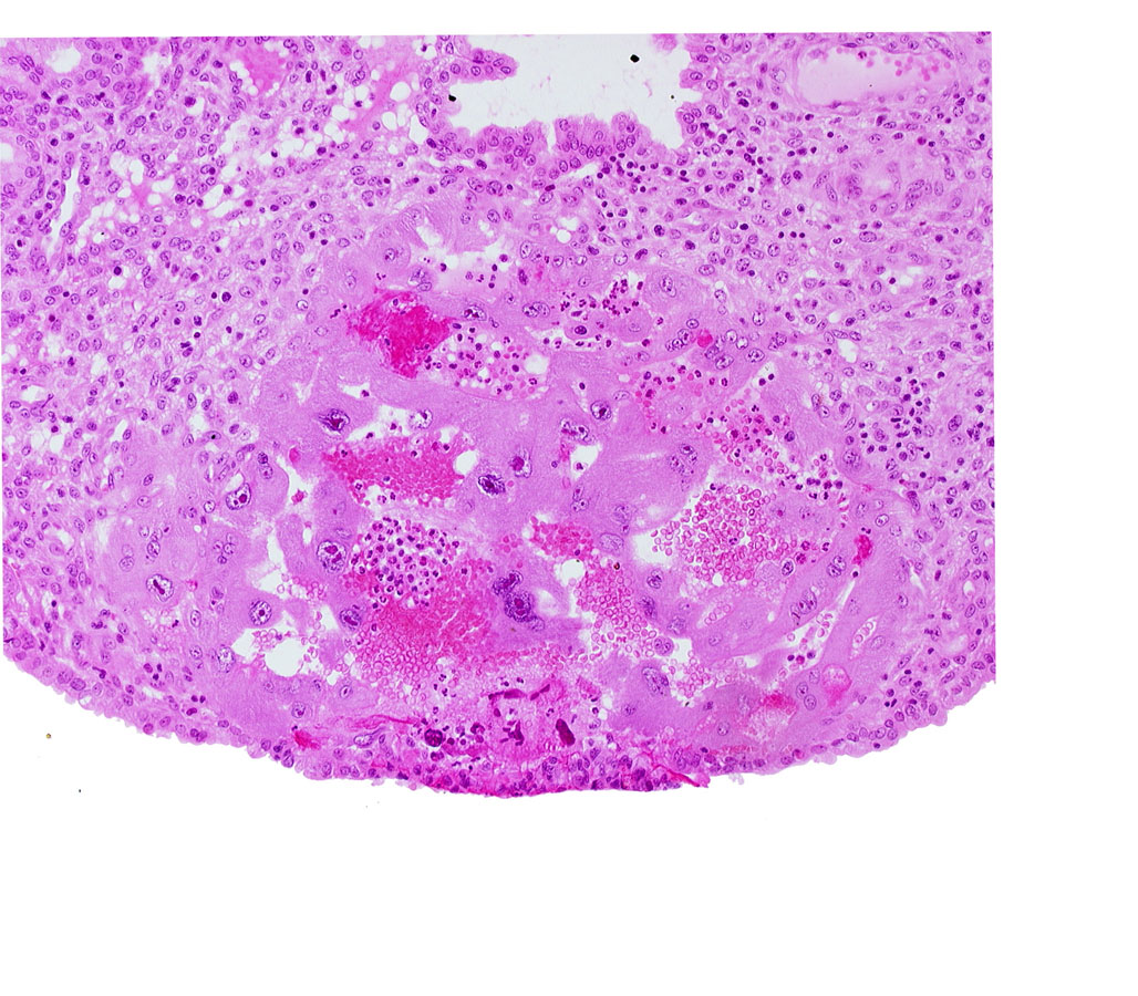 endometrial epithelium, lacunar vascular circle, lumen of endometrial gland, maternal blood cells in trophoblast lacuna, uterine cavity