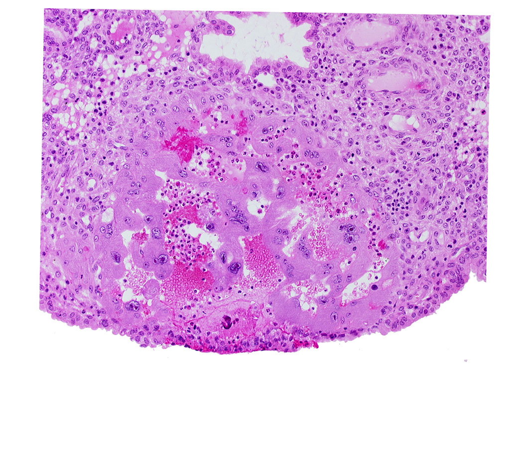 endometrial epithelium, endometrial sinusoid, lacunar vascular circle, lumen of endometrial gland, uterine cavity