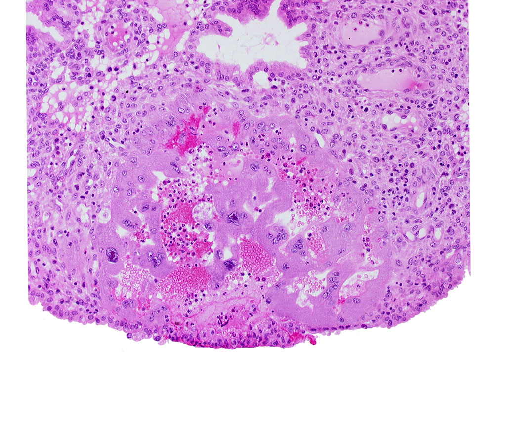 endometrial epithelium, endometrial sinusoid, endometrial stroma (decidua), intercommunicating sinusoid, lacunar vascular circle, lumen of endometrial gland, syncytiotrophoblast, uterine cavity