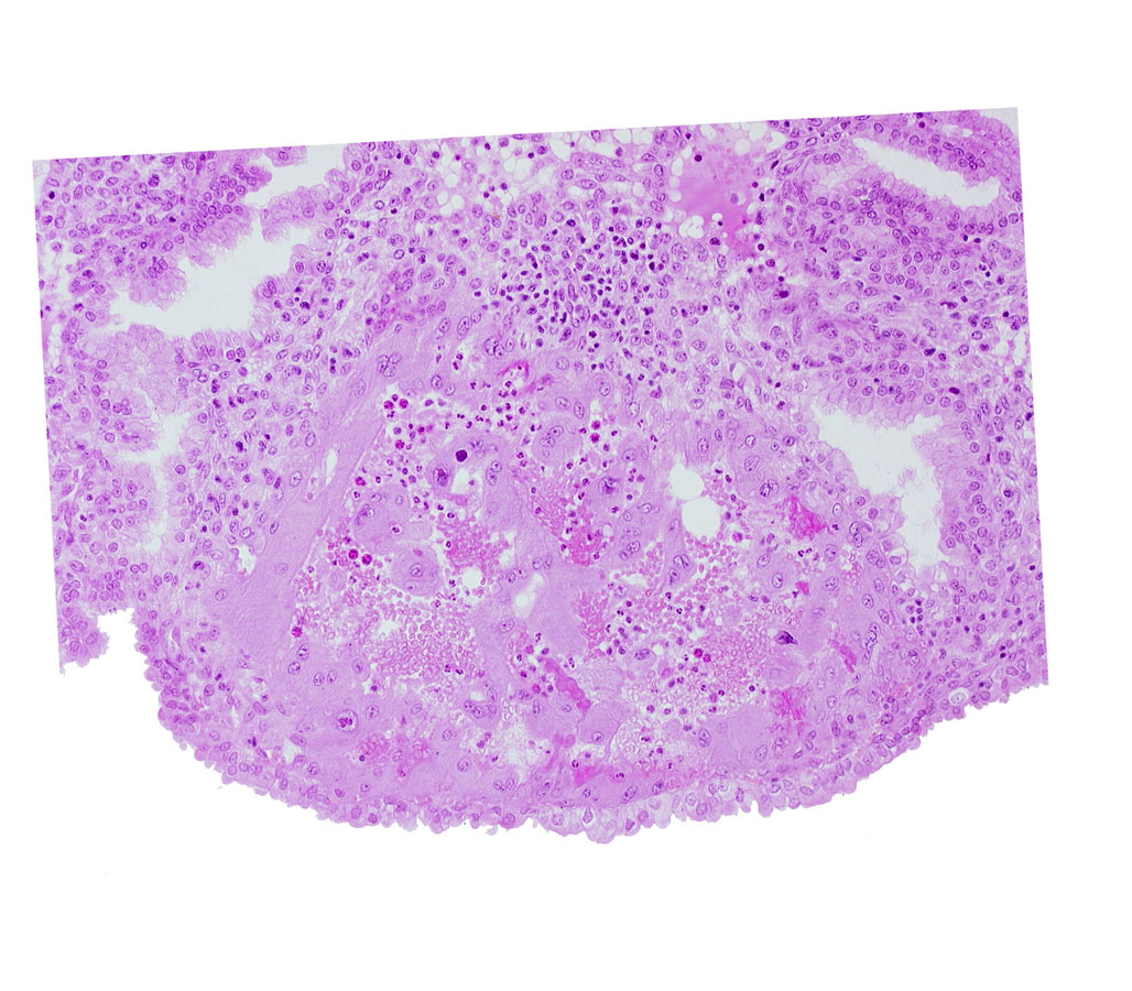 endometrial epithelium, maternal blood cells in trophoblast lacuna, syncytiotrophoblast, uterine cavity