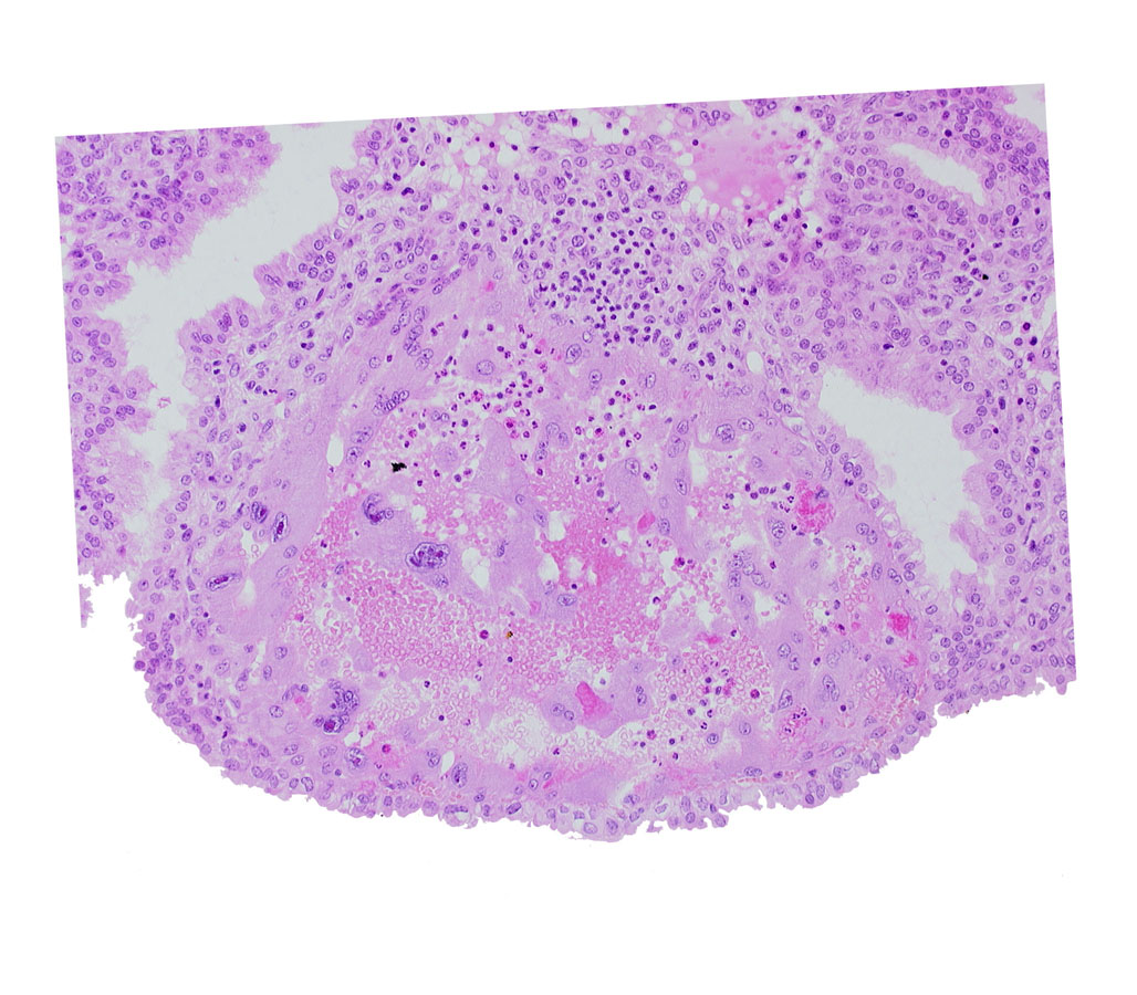 endometrial epithelium, maternal blood cells in trophoblast lacuna, mouth of endometrial gland, syncytiotrophoblast