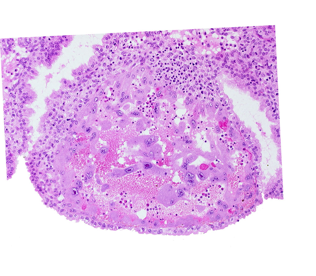 lumen of endometrial gland, maternal blood cells in trophoblast lacuna, mouth of endometrial gland