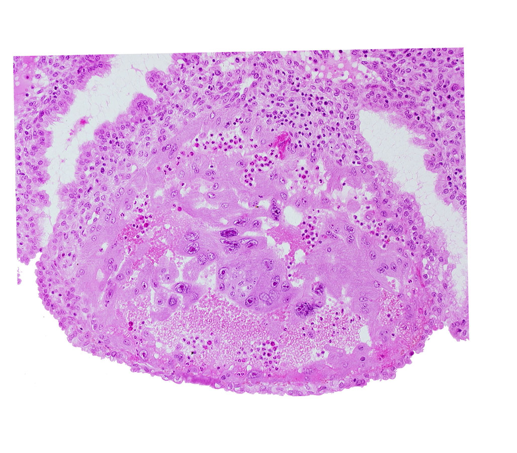 endometrial epithelium, lumen of endometrial gland, maternal blood cells in trophoblast lacuna, mouth of endometrial gland