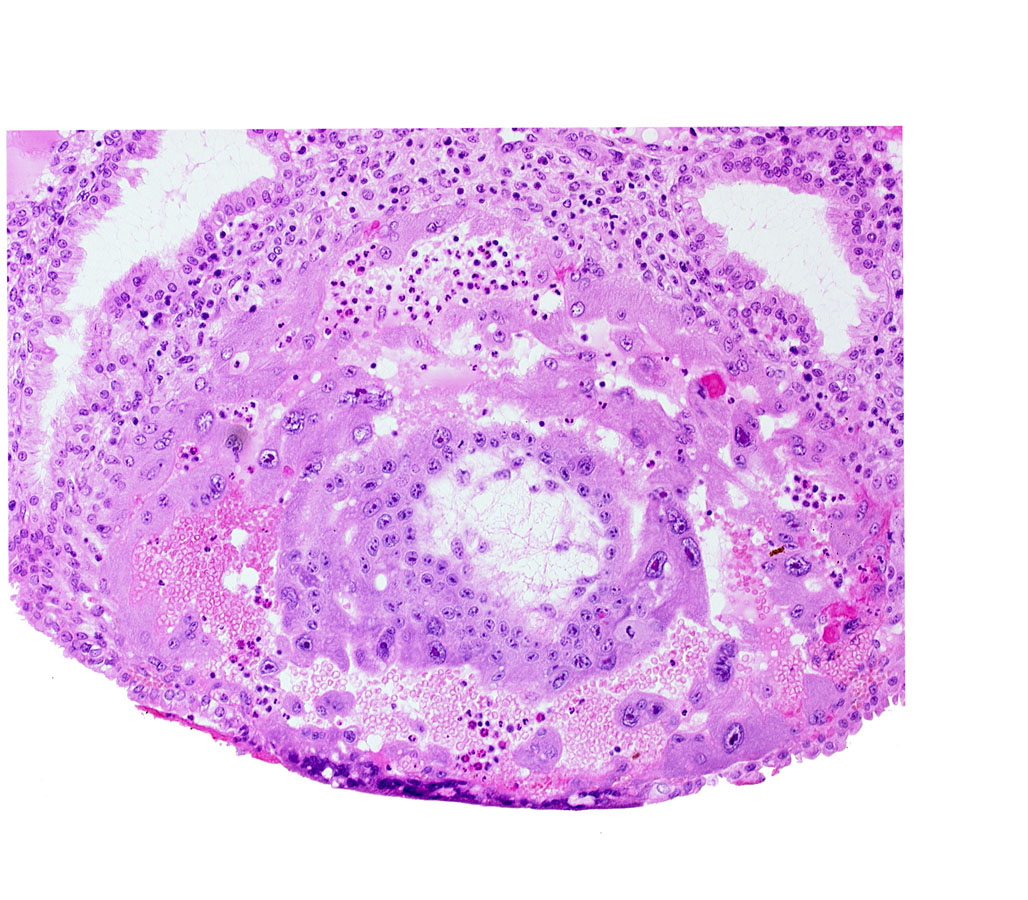 chorionic cavity, disrupted endometrial epithelium, lacunar vascular circle, syncytiotrophoblast, uterine cavity