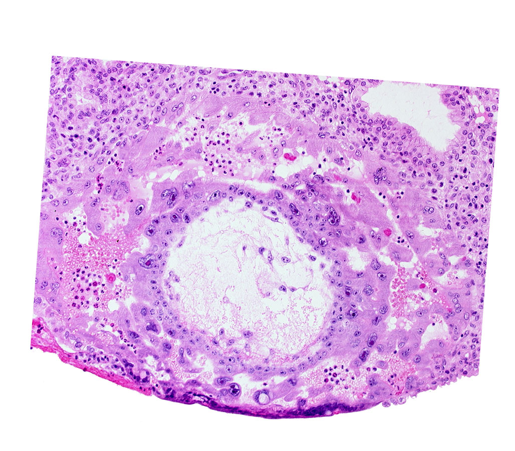 chorion, cytotrophoblast, disrupted endometrial epithelium, extra-embryonic reticulum, lacunar vascular circle
