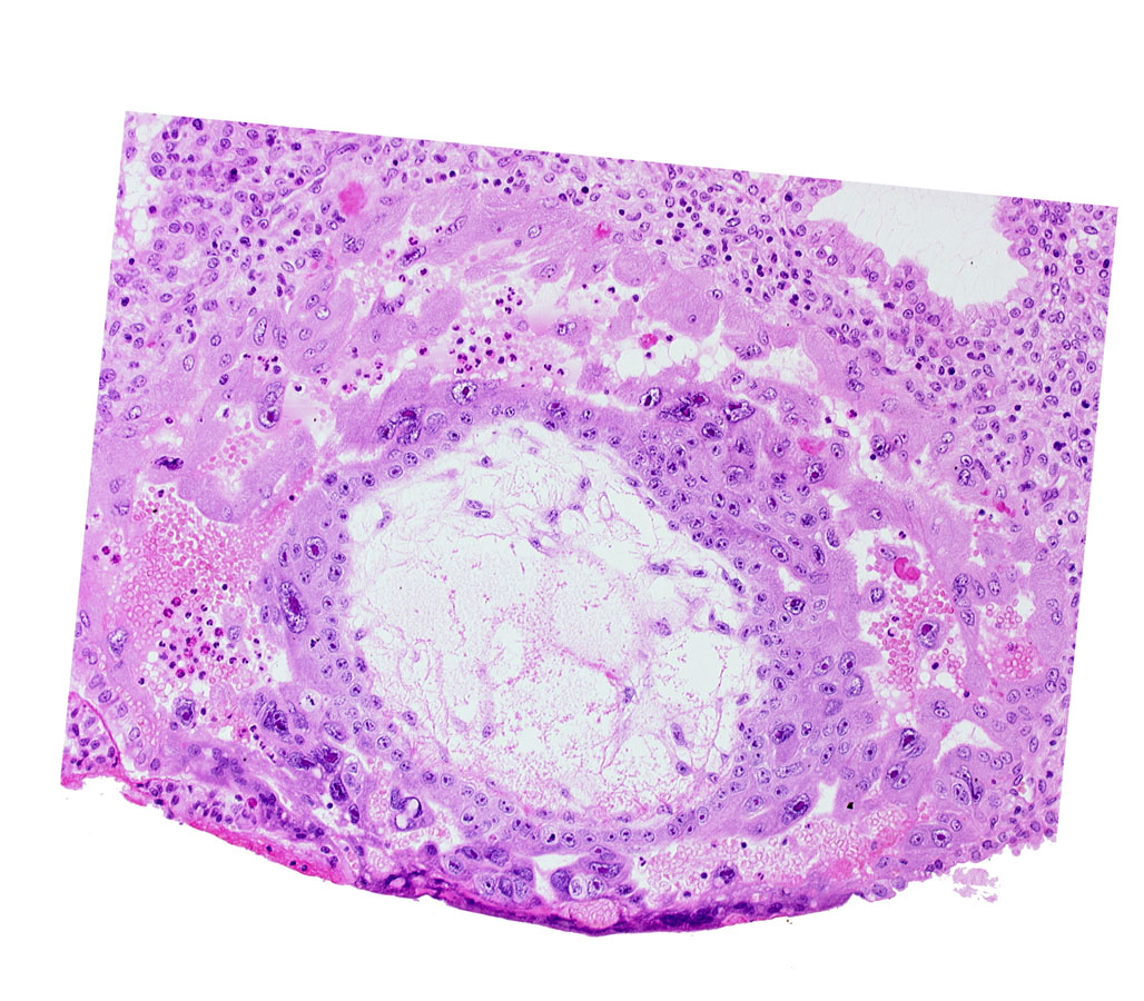 chorionic cavity, extra-embryonic reticulum, lacunar vascular circle, syncytiotrophoblast