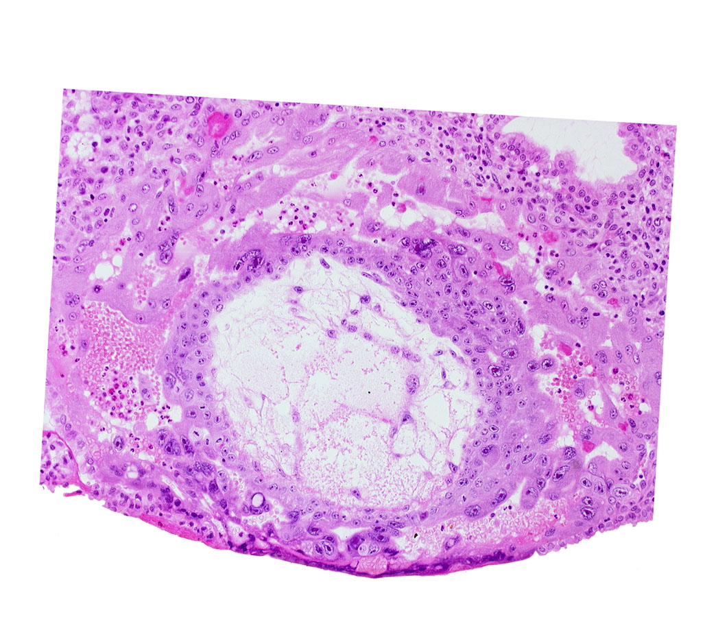 extra-embryonic reticulum, lacunar vascular circle, uterine cavity