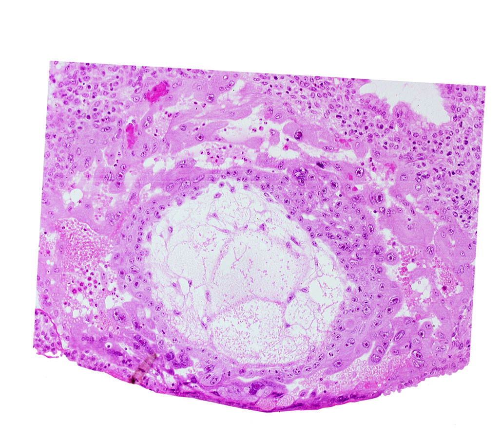 chorionic cavity, disrupted endometrial epithelium, lacunar vascular circle, uterine cavity