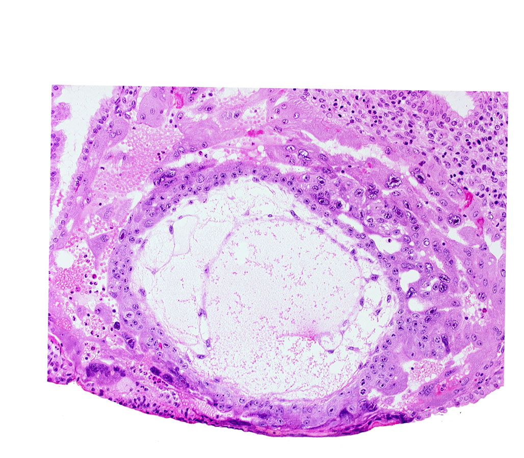chorionic cavity, exocoelomic (Heuser's) membrane, extra-embryonic mesoblast, uterine cavity