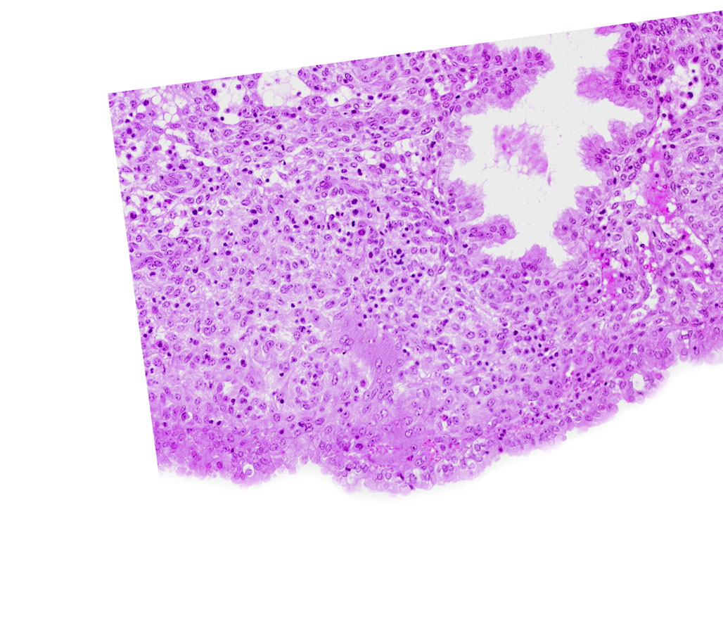 intact endometrial epithelium, lumen of endometrial gland, uterine cavity