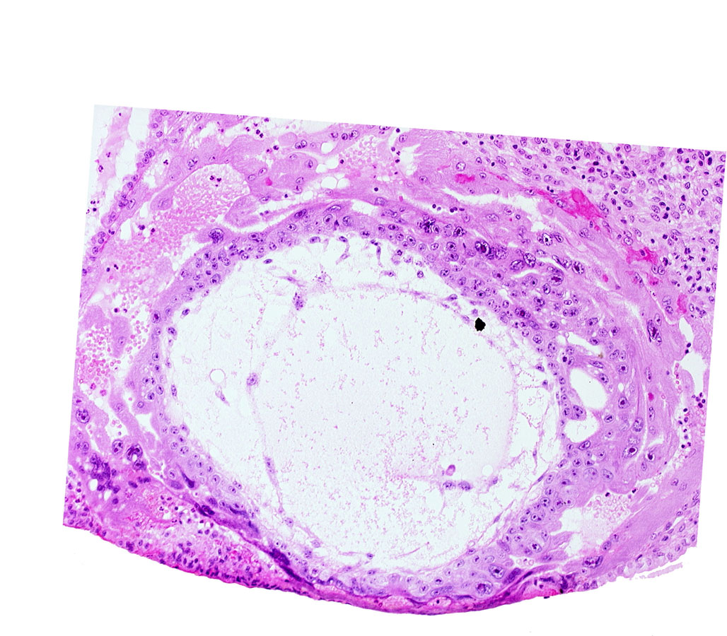 chorionic cavity, cytotrophoblast, extra-embryonic mesoblast, primary umbilical vesicle cavity, uterine cavity