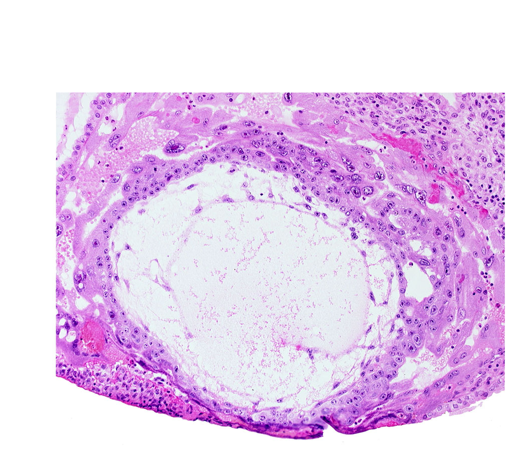 chorionic cavity, primary umbilical vesicle cavity, uterine cavity