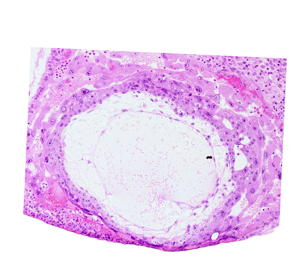 chorionic cavity, extra-embryonic mesoblast, fibrous coagulum, uterine cavity