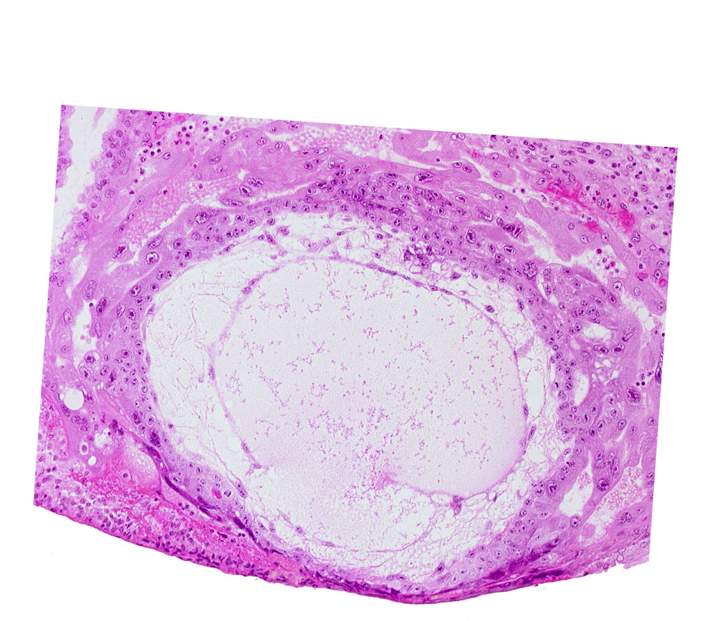 edge of embryonic disc, exocoelomic (Heuser's) membrane, lacunar vascular circle, trophoblast lacunae