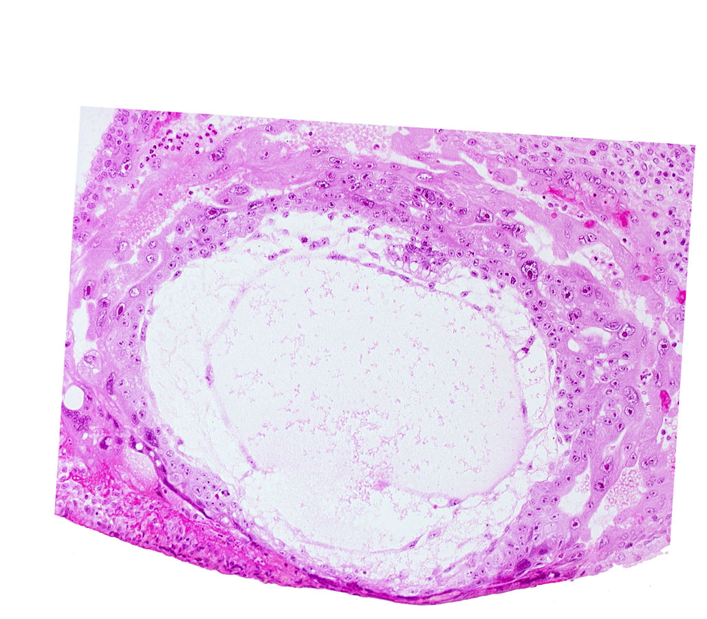 chorionic cavity, extra-embryonic mesoblast, primary umbilical vesicle cavity, uterine cavity