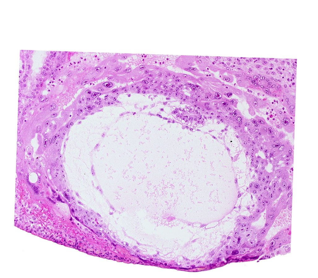 chorionic cavity, epiblast, exocoelomic (Heuser's) membrane, extra-embryonic mesoblast, hypoblast, primary umbilical vesicle cavity