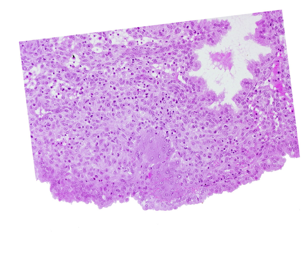 intact endometrial epithelium, lumen of endometrial gland, syncytiotrophoblast, uterine cavity