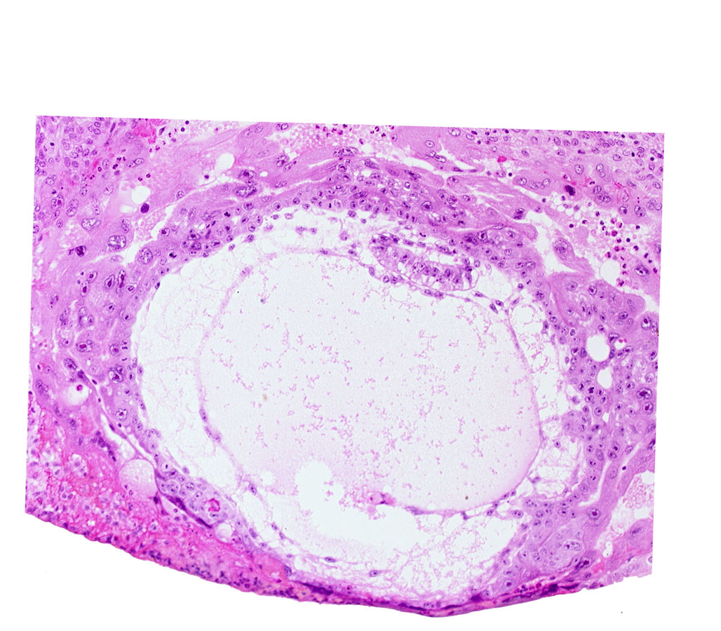 amnioblast(s), amniotic cavity, chorionic cavity, epiblast, extra-embryonic endoblast, extra-embryonic mesoblast, hypoblast, previllus mesoblast clump, primary umbilical vesicle cavity
