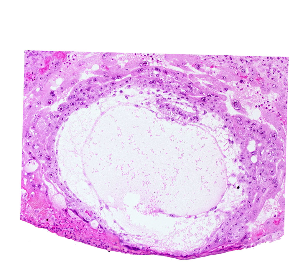 amniotic cavity, chorionic cavity, extra-embryonic mesoblast, primary umbilical vesicle cavity