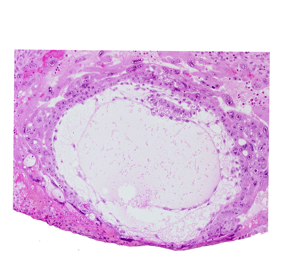 amniotic cavity, chorionic cavity, extra-embryonic mesoblast, primary umbilical vesicle cavity