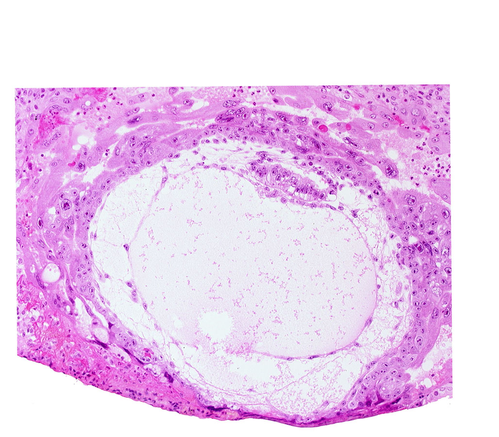 amniotic cavity, chorionic cavity, epiblast vacuole, hypoblast, primary umbilical vesicle cavity