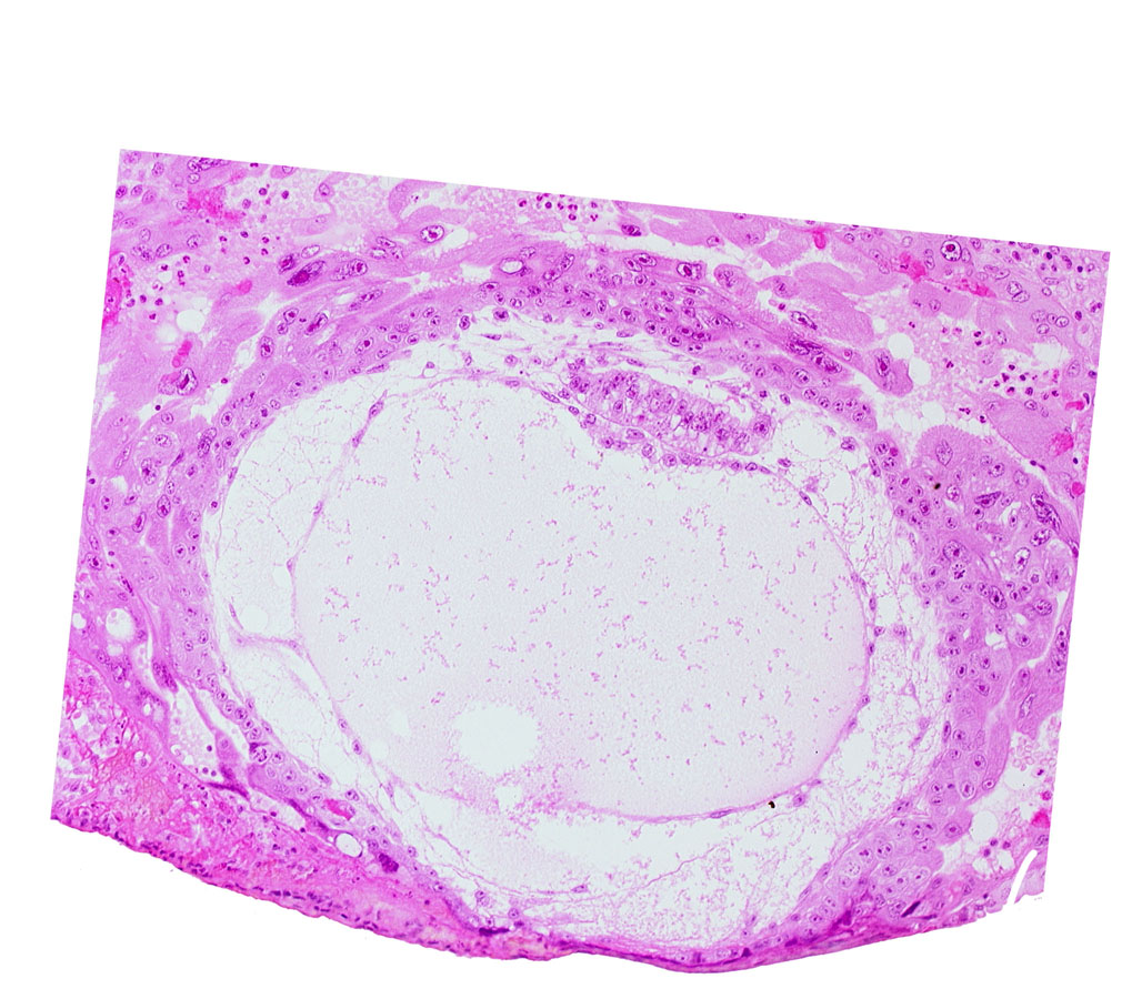 amniotic cavity, chorionic cavity, epiblast vacuole, hypoblast, primary umbilical vesicle cavity