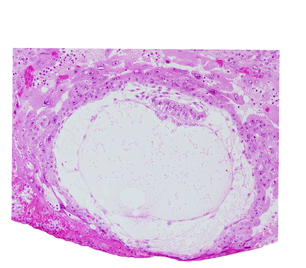 amniotic cavity, angioblastic tissue of mesoblast, chorionic cavity, condensed extra-embryonic mesoblasts at caudal end of embryonic disc, epiblast vacuole, exocoelomic (Heuser's) membrane, hypoblast, presumptive prechordal plate