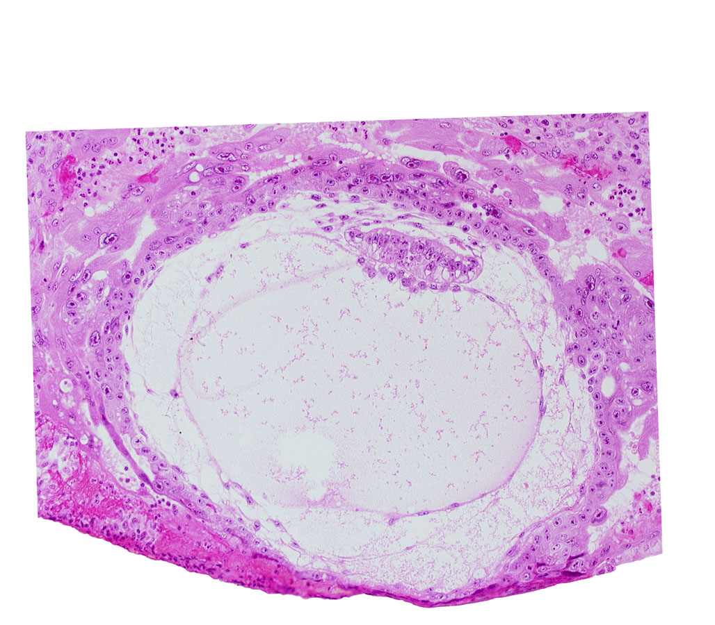amniotic cavity, angioblastic tissue of mesoblast, chorionic cavity, condensed extra-embryonic mesoblasts at caudal end of embryonic disc, epiblast vacuole, exocoelomic (Heuser's) membrane