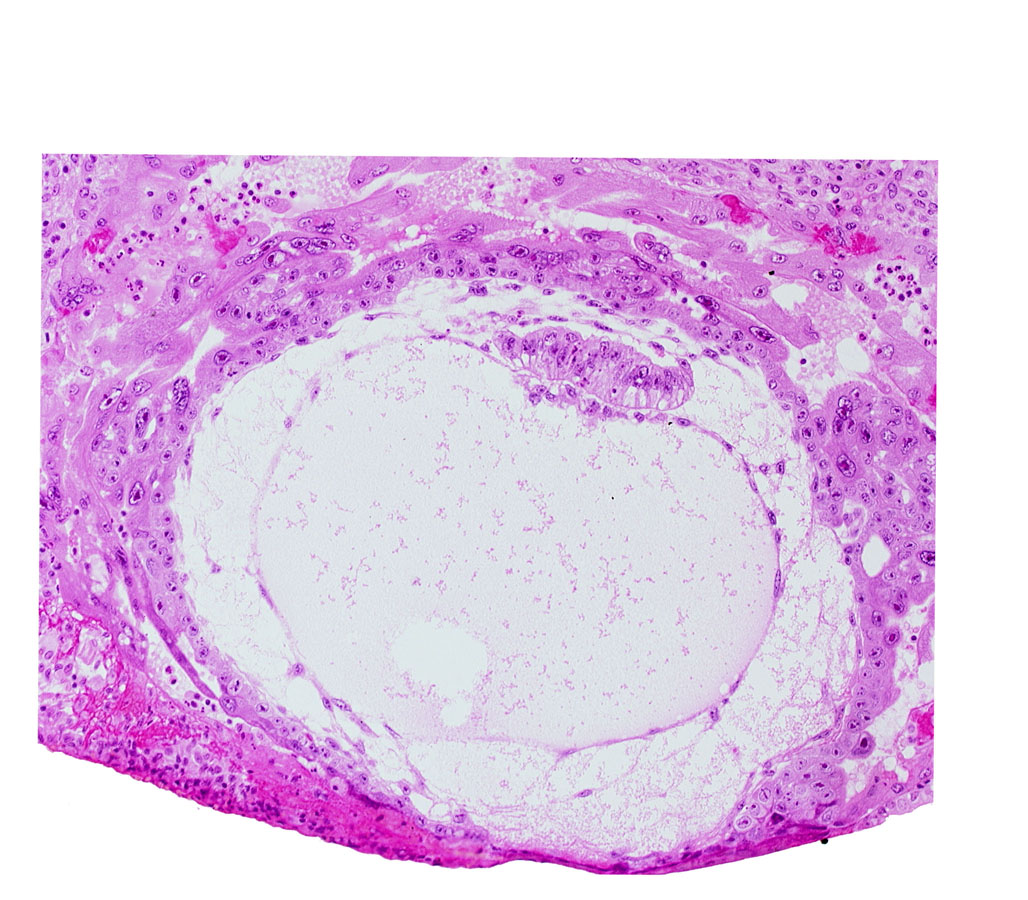 amniotic cavity, angioblastic tissue of mesoblast, chorionic cavity, epiblast vacuole, exocoelomic (Heuser's) membrane