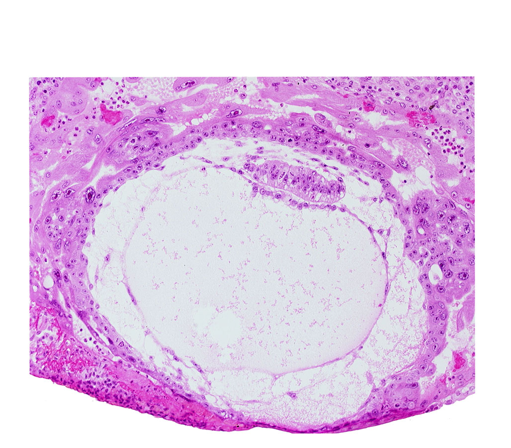 chorionic cavity, exocoelomic (Heuser's) membrane, primary umbilical vesicle cavity
