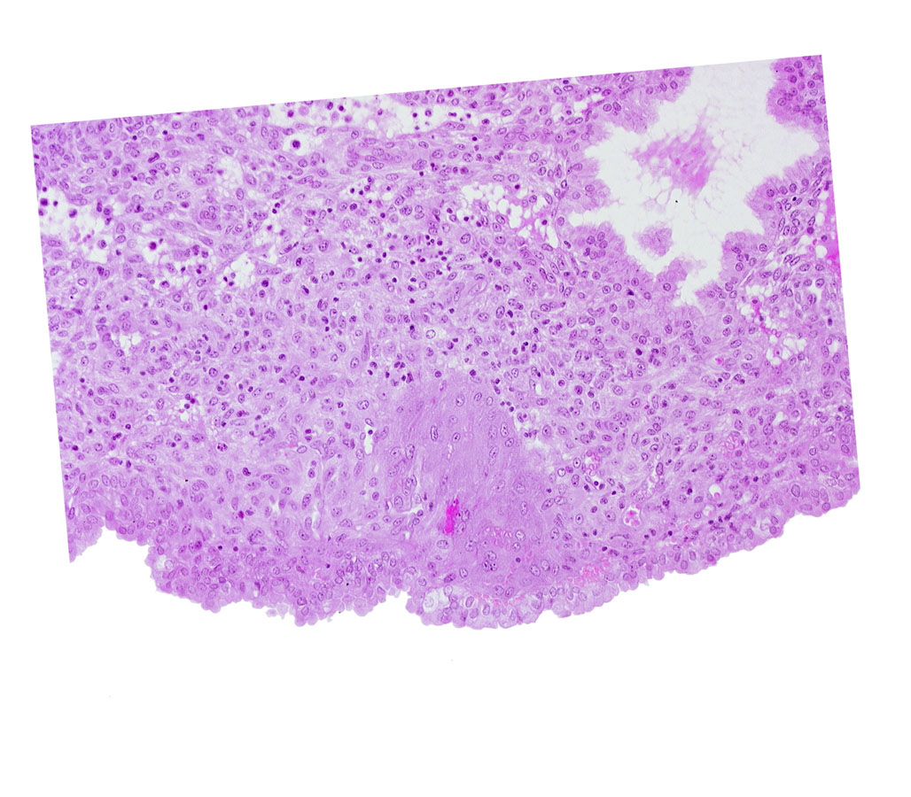 intact endometrial epithelium, lumen of endometrial gland, syncytiotrophoblast, uterine cavity