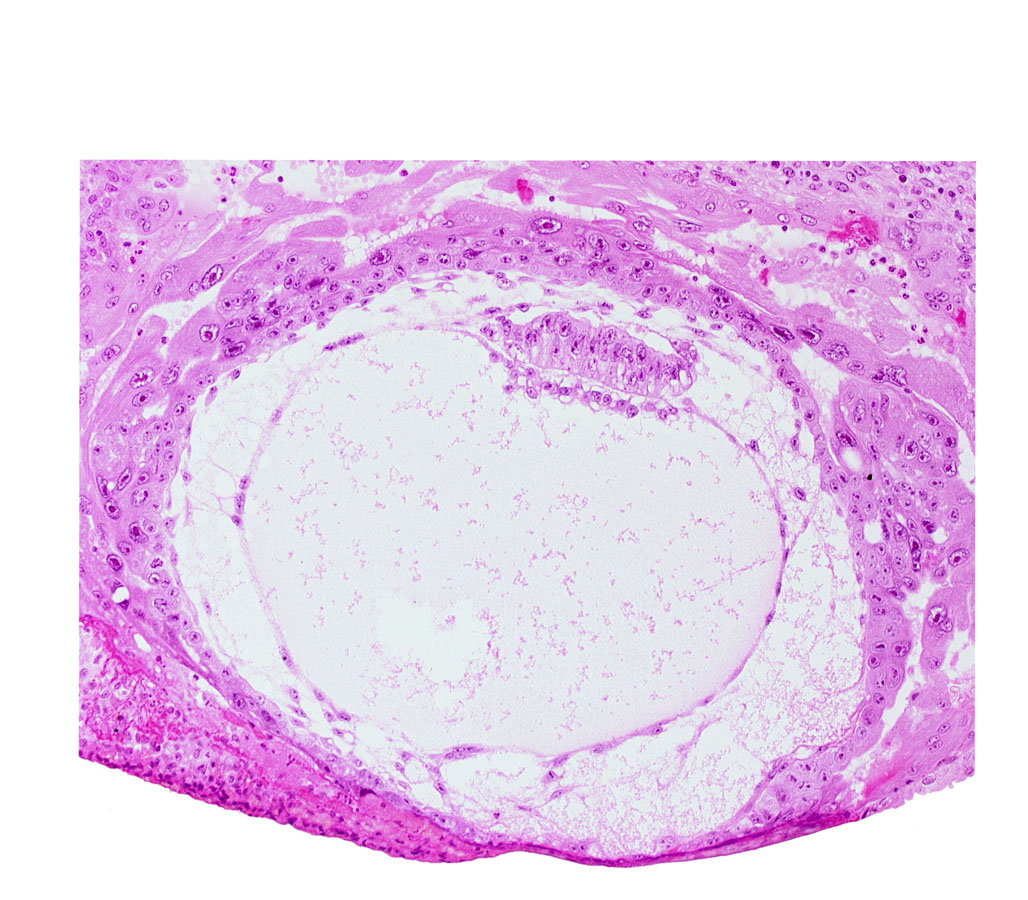 amniotic cavity, epiblast vacuole, fibrous coagulum, lacunar vascular circle