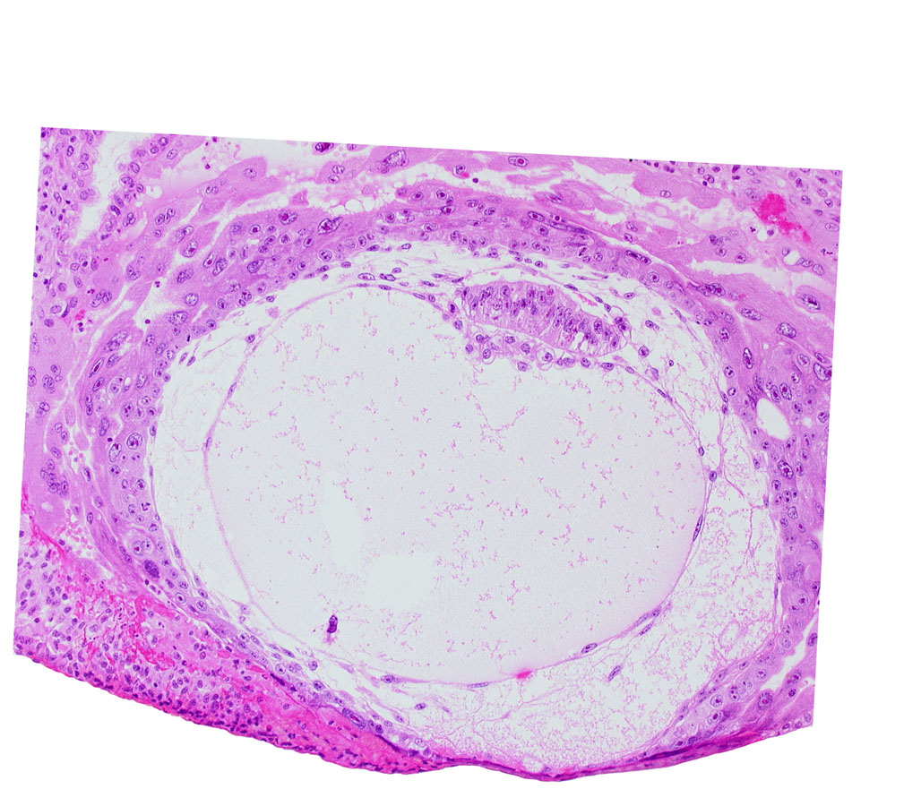 amnion, amniotic cavity, chorionic cavity, epiblast vacuole